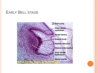 EARLY BELL STAGE
 
