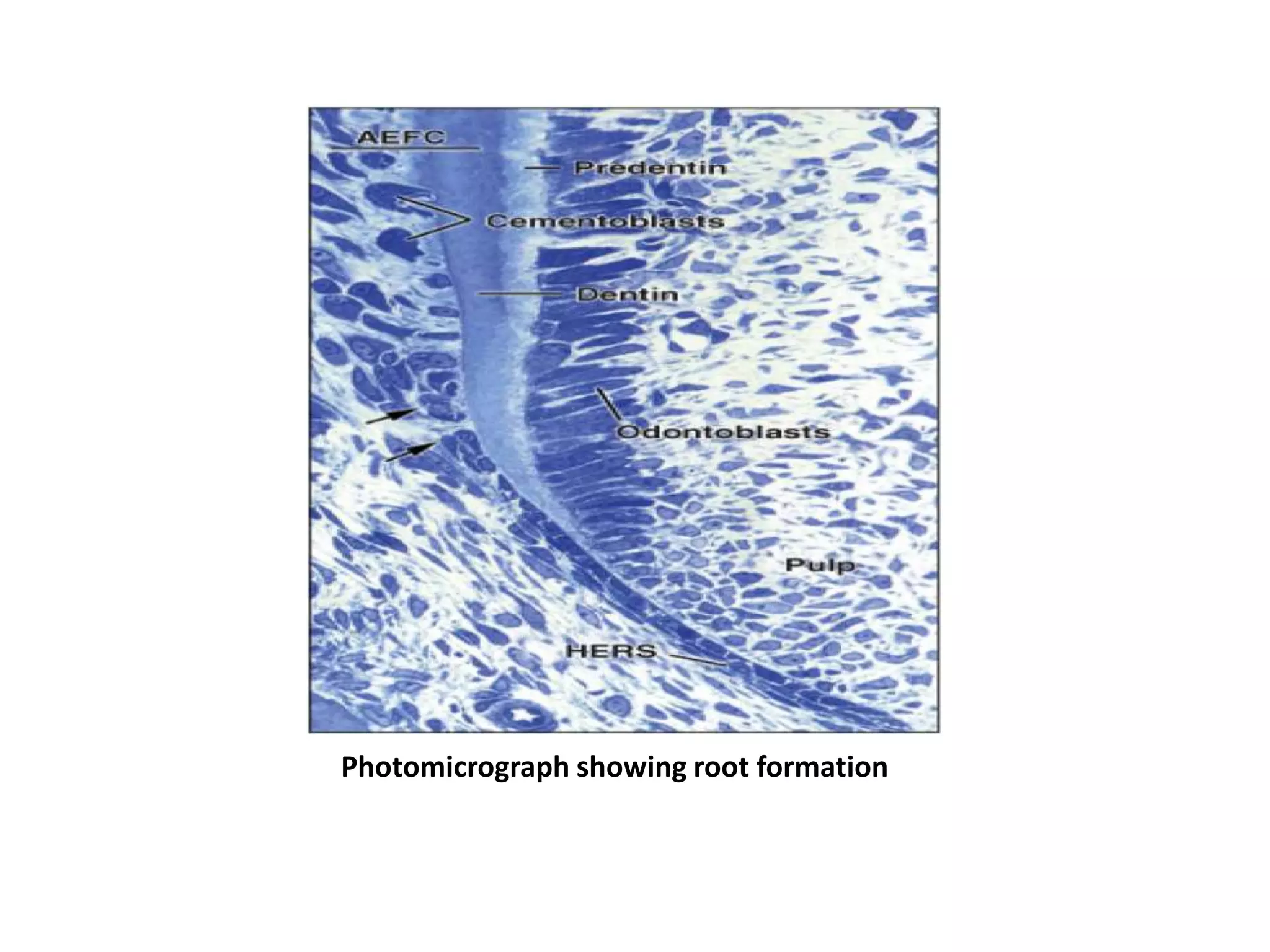 Photomicrograph showing root formation
 