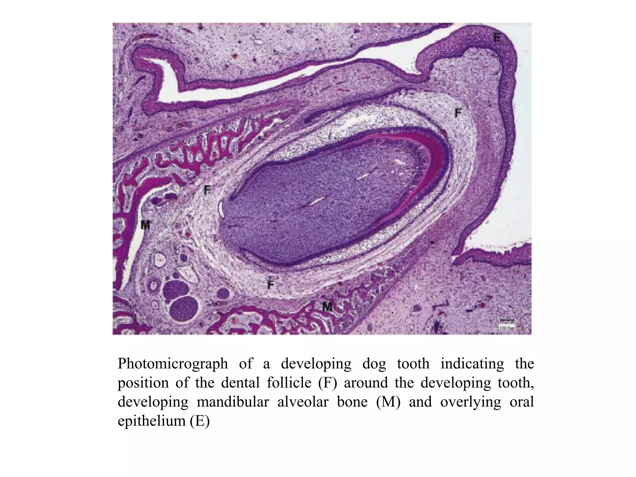 Photomicrograph of a developing dog tooth indicating the
position of the dental follicle (F) around the developing tooth,
developing mandibular alveolar bone (M) and overlying oral
epithelium (E)
 