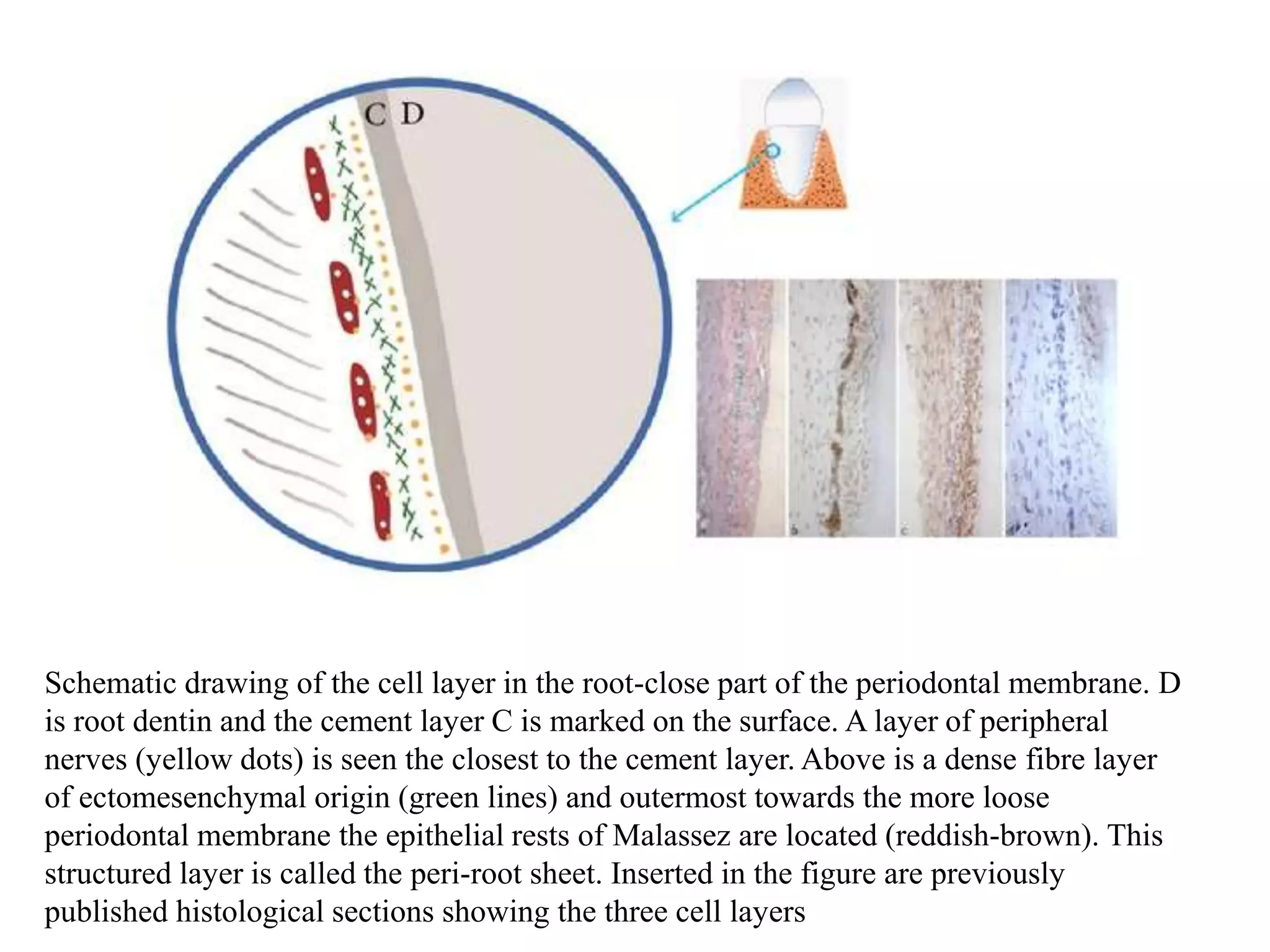 Schematic drawing of the cell layer in the root-close part of the periodontal membrane. D
is root dentin and the cement layer C is marked on the surface. A layer of peripheral
nerves (yellow dots) is seen the closest to the cement layer. Above is a dense fibre layer
of ectomesenchymal origin (green lines) and outermost towards the more loose
periodontal membrane the epithelial rests of Malassez are located (reddish-brown). This
structured layer is called the peri-root sheet. Inserted in the figure are previously
published histological sections showing the three cell layers
 