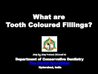 What are
Tooth Coloured Fillings?
Department of Conservative Dentistry
The Dental Specialists
Hyderabad, India
Step by Step Protocol followed at
 