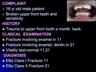 COMPLAINT
 18 yr old male patient
 Broken upper front teeth and
sensitivity
HISTORY
 Trauma to upper front tooth a month back.
CLINICAL EXAMINATION
 Fracture involving enamel in 11
 Fracture involving enamel, dentin in 21
 Vitality test-normal 11,21
DIAGNOSIS
 Ellis Class I Fracture 11
 Ellis Class II Fracture 21
 