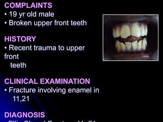COMPLAINTS
• 19 yr old male
• Broken upper front teeth
HISTORY
• Recent trauma to upper
front
teeth
CLINICAL EXAMINATION
• Fracture involving enamel in
11,21
DIAGNOSIS
 