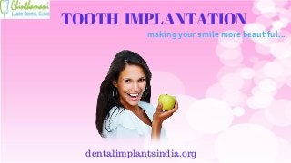 TOOTH IMPLANTATION
dentalimplantsindia.org
making your smile more beautiful...
 