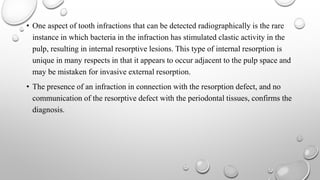 • One aspect of tooth infractions that can be detected radiographically is the rare
instance in which bacteria in the infraction has stimulated clastic activity in the
pulp, resulting in internal resorptive lesions. This type of internal resorption is
unique in many respects in that it appears to occur adjacent to the pulp space and
may be mistaken for invasive external resorption.
• The presence of an infraction in connection with the resorption defect, and no
communication of the resorptive defect with the periodontal tissues, confirms the
diagnosis.
 