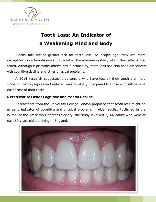 Tooth Loss An Indicator of a Weakening Mind and Body
