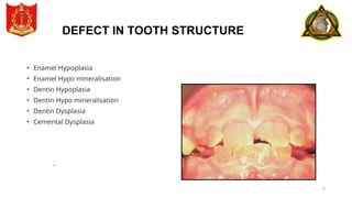 Sharp Linear Defect Tooth reasons for TOOTH LOSS Power point.pptx