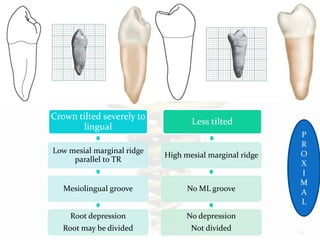 Deep Ridge Vs Shallow Ridge Tooth Tooth morphology...the architecture of part 3.....premolar and molar | PPTX