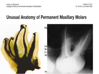Molar Patterns Tooth morphology...the architecture of part 3.....premolar and molar | PPTX