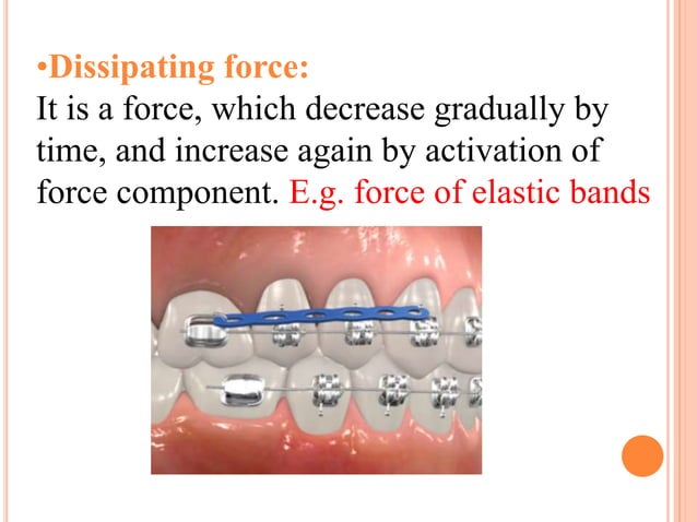 Tooth movement in orthodontics how and why | PPTX | Dental Health ...