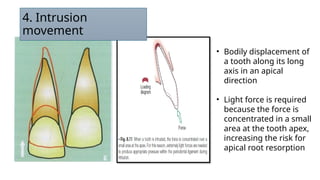 Apical Direction Theories and types of tooth movement .pptx