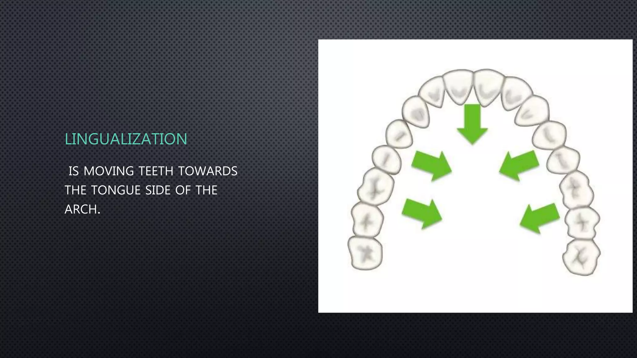 Orthodontic Tooth movement types | PPTX