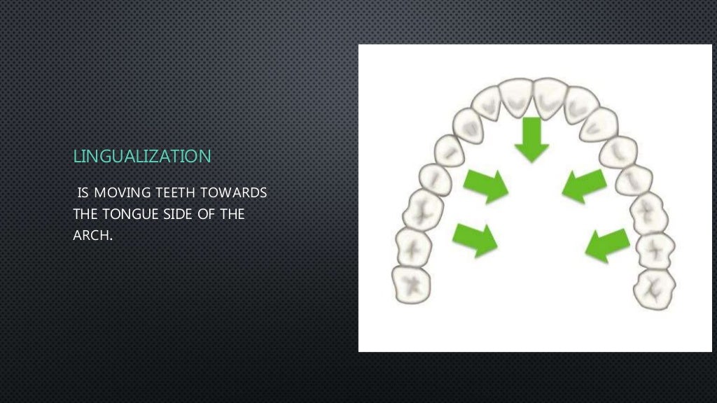 Orthodontic Tooth movement types