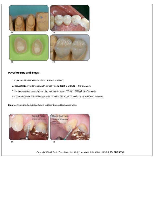 Zirconia crown preparation