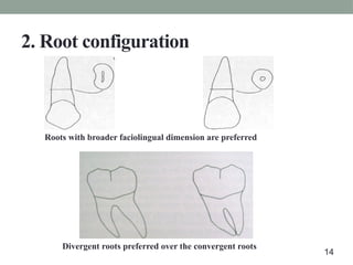 2. Root configuration
Roots with broader faciolingual dimension are preferred
Divergent roots preferred over the convergent roots
14
 