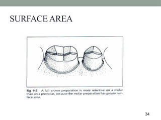 SURFACEAREA
34
 