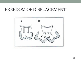 FREEDOM OF DISPLACEMENT
35
 