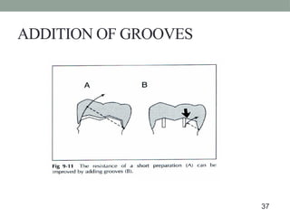 ADDITION OF GROOVES
37
 