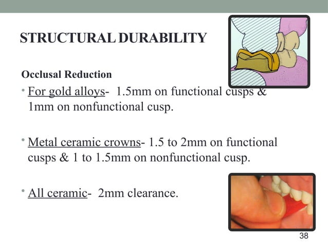 tooth preparation and it's modifications | PPT