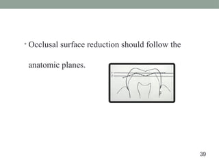 • Occlusal surface reduction should follow the
anatomic planes.
39
 