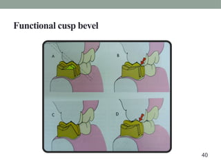 Functional cusp bevel
40
 