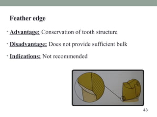 Feather edge
• Advantage: Conservation of tooth structure
• Disadvantage: Does not provide sufficient bulk
• Indications: Not recommended
43
 