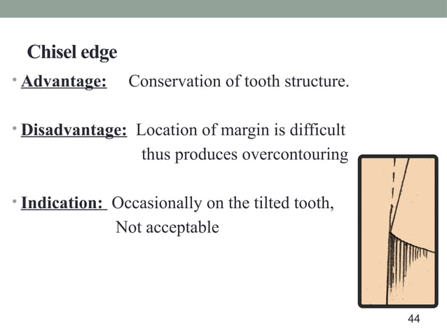 tooth preparation and it's modifications | PPT