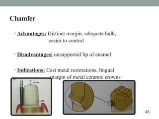 Chamfer
• Advantages: Distinct margin, adequate bulk,
easier to control
• Disadvantages: unsupported lip of enamel
• Indications: Cast metal restorations, lingual
margin of metal ceramic crowns
45
 