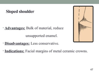 Sloped shoulder
• Advantages: Bulk of material, reduce
unsupported enamel.
• Disadvantages: Less conservative.
• Indications: Facial margins of metal ceramic crowns.
47
 