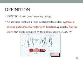DEFINITION
• PONTIC - Latin ‘pons’ meaning bridge.
• An artificial tooth on a fixed dental prosthesis that replaces a
missing natural tooth, restores its function, & usually fills the
space previously occupied by the clinical crown. (G.P.T-9)
68
 