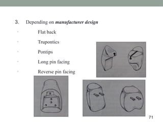 3. Depending on manufacturer design
▫ Flat back
▫ Trupontics
▫ Pontips
▫ Long pin facing
▫ Reverse pin facing
71
 