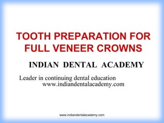 TOOTH PREPARATION FOR
FULL VENEER CROWNS
INDIAN DENTAL ACADEMY
Leader in continuing dental education
www.indiandentalacademy.com

www.indiandentalacademy.com

 