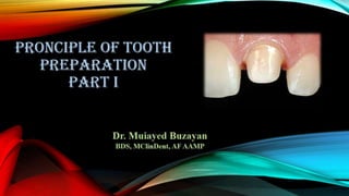Tooth preparation part 1