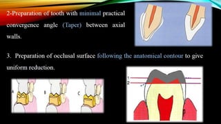Tooth preparation part 1
