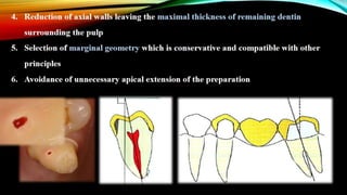 Tooth preparation part 1