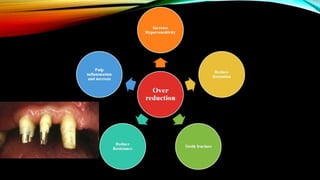 Tooth preparation part 1