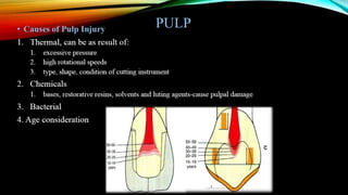Tooth preparation part 1
