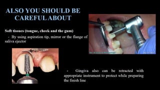 Tooth preparation part 1