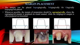 Tooth preparation part 1