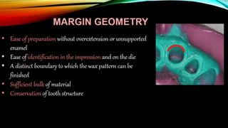 Tooth preparation part 1