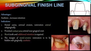 Tooth preparation part 1