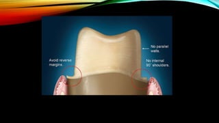 Tooth preparation part 1