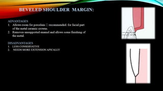 Tooth preparation part 1