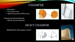 Tooth preparation part 1