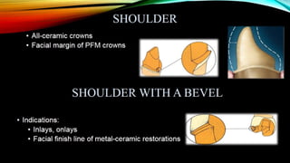 Tooth preparation part 1