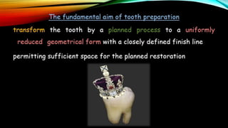 Tooth preparation part 1