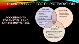 Tooth preparation part 1