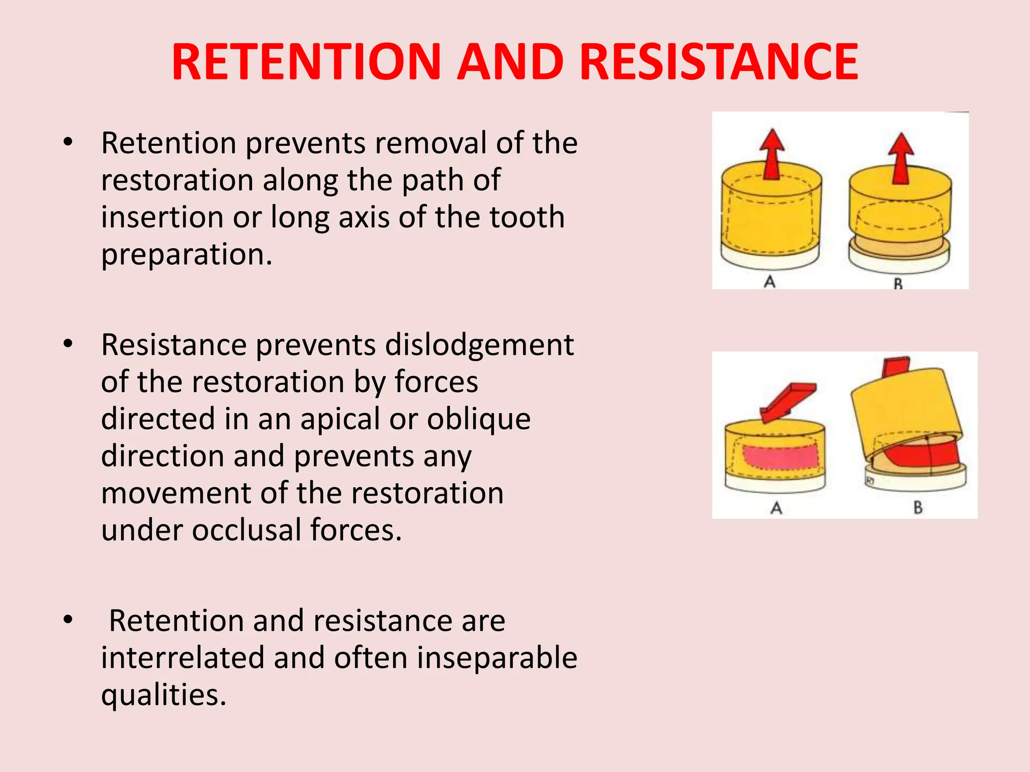 Apical Direction PRINCIPLES OF TOOTH PREPARATION ppt given | PPTX