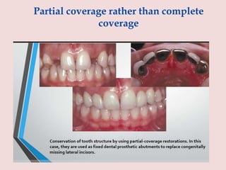 Partial coverage rather than complete
coverage
 