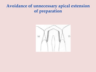 Avoidance of unnecessary apical extension
of preparation
 